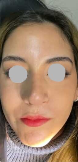 Facial balance after